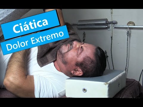 ciática |  nervio ciático | radiculitis  |  Dolor extremo