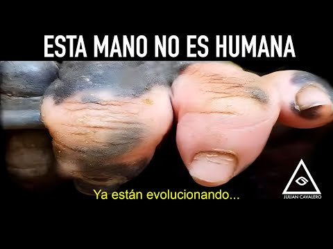 El insólito caso de Anaka: la especie que poco a poco se convierte en... (Documental)