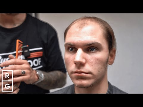 Cutting the COMB-OVER 😱 BALDING Since 19! | Talking Hair Loss S2 EP10