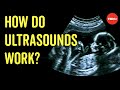 Ultrasound and Its Applications