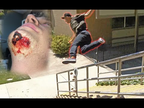 My Worst Slam Ever!