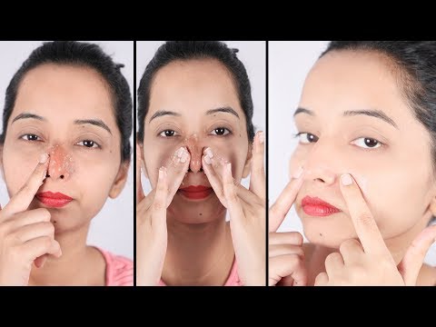 Colgate 5 मिनट में Black Heads ऐसे गायब कर देगा जैसे कभी थे ही नहीं | Remove Blackheads At Home