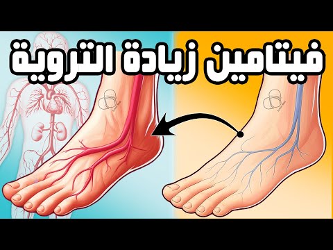 علاج نقص التروية وضعف ضخ الدم || الدوخة, ألم الصدر, انتفاخ الأرجل ,اختفاء الشعر, بروده اﻷطراف