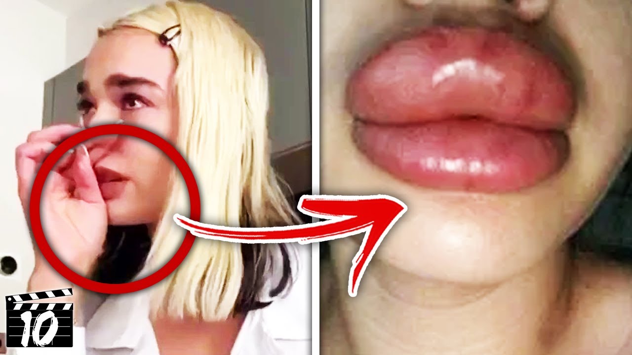 Top 10 Celebrities Who Went WAY Too Far With Plastic Surgery￼