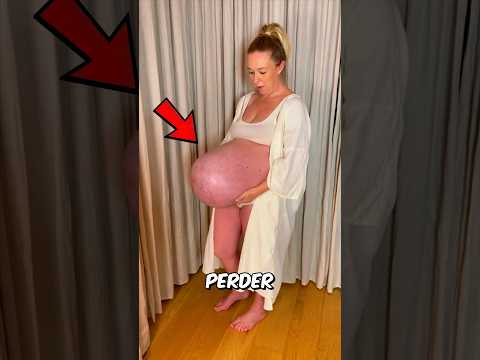 Embarazada de Trillizos 👶👶👶: El Médico Le Aconsejó, ¡Pero Ella Dijo NO! 😳
