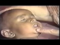 Child Health Assessment Techniques
