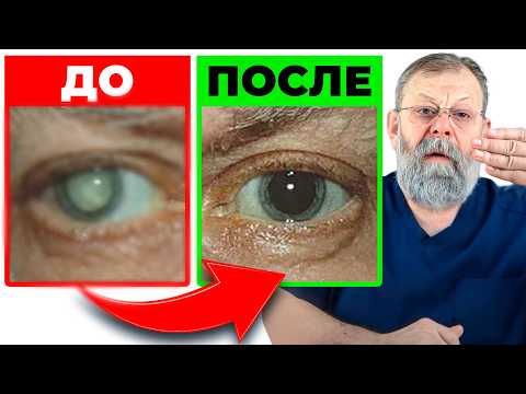 Катаракта. 99% людей не знают этого 1 упражнения!