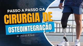 Como É Feita a Cirurgia de Prótese de Osteointegração?