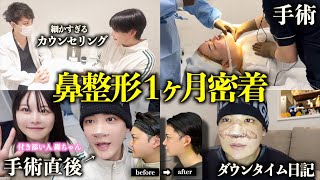 【鼻整形】人生三度目の鼻整形で理想の鼻を手に入れました！〜当日から1ヶ月経過まで全てお見せします〜