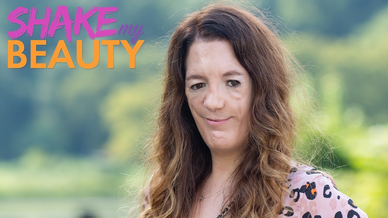 Actress with facial difference redefines beauty - shake my beauty