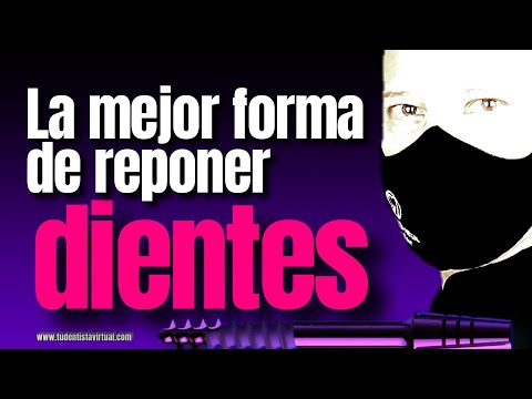 RECUPERAR DIENTES PERDIDOS de FORMA FIJA sin INJERTOS de HUESO SI es POSIBLE