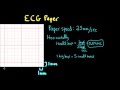 ECG Paper Measurements and Interpretations