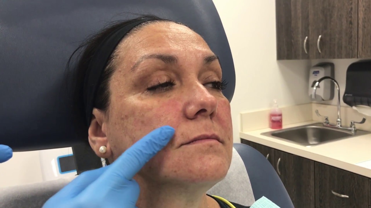 Woman receiving skincare treatment in clinical setting.