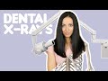 Digital X-Rays in Dentistry