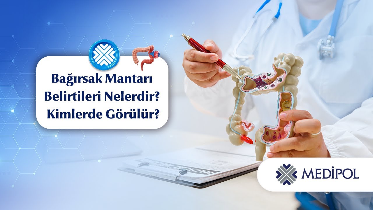 Bağırsak Mantarı Neden Olur? Belirtileri ve Tedavi Süreci