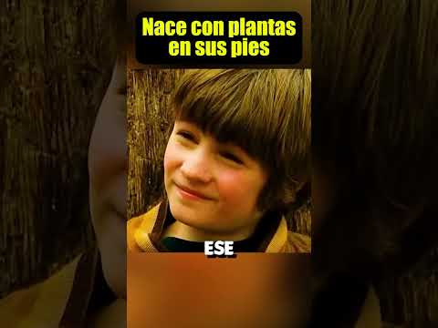 Nace con plantas en sus pies 馃尡 #youtubeshorts
