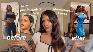 how I got my SUMMER body without Ozempic & you can too! ♡ lose face fat/ belly fat