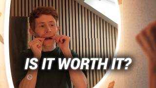 I Wish I'd Known This Before Getting Invisalign