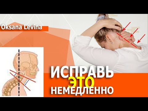 Здоровая шея - молодое лицо. После этих упражнений, лицо молодеет. Устраняем шейный гиперлордоз.
