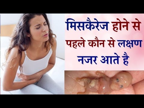 गर्भपात होने से पहले नजर आते है ये लक्षण | Symptoms of Miscarriage during early Pregnancy in Hindi