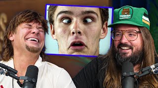Are Cross Eyed People Becoming Less Common?