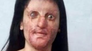 She Married The Man That Did This To Her… 😔