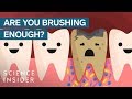 Impact of Periodontal Disease on Health