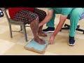Foot Impression Techniques and Procedures