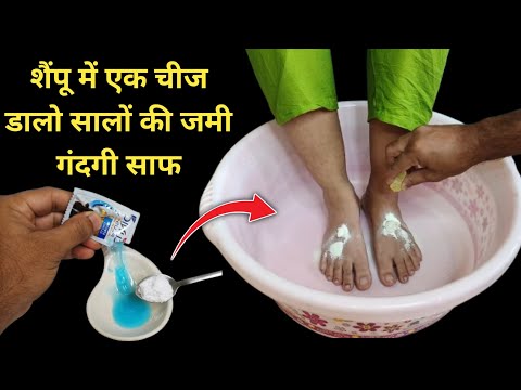 गर्दन हाथ पैर की सालों पुरानी जमी मैल को साफ कर गोरा कर देगी | Dark Neck, Hand & Feet Whitening