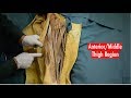 Muscle Anatomy and Function Assessment