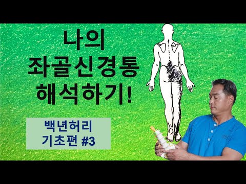 나의 좌골신경통 해석하기! (백년허리 기초편#3)