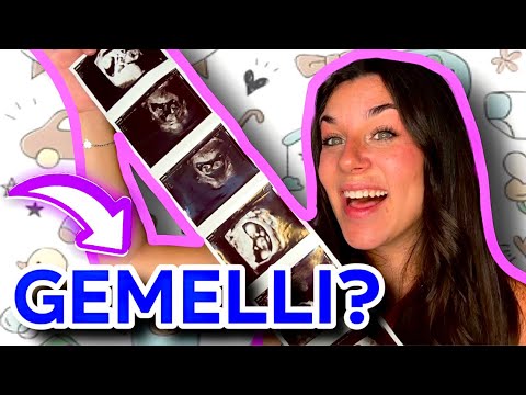 ASPETTO DUE GEMELLI?! RISPONDO Alle Vostre DOMANDE Sulla GRAVIDANZA