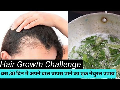 Oil for Hair Regrowth & Thickness , 1 Month Hair Regrowth Challenge 🤨