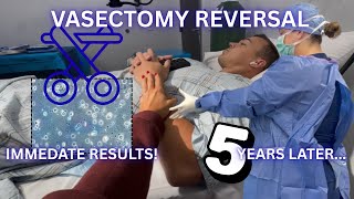 SURGRY VLOG! REVERSING MY HUSBANDS VASECTOMY AFTER 5 YEARS!