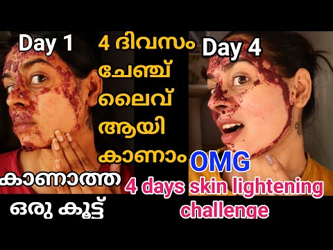 നിറം വക്കണം എന്നുള്ളവർക്കും വിവാഹത്തിന് ഒരുങ്ങുന്നവർക്കും റിസൾട്ട്‌ കിട്ടുന്ന ഒരു പുതിയ കൂട്ട് #skin