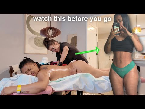 POV: Documenting My Lipo360 Plastic Surgery Full Journey @ 22 | Dr. Erickson Houston Experience Vlog