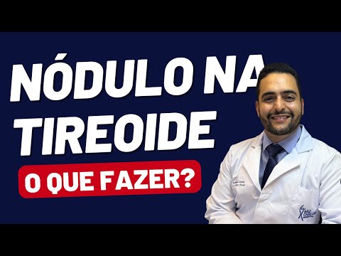 Nódulo na Tireoide: O Que Fazer? Passo a Passo para Cuidar da Sua Saúde!