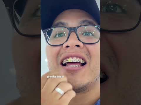 Pobre labio por los BRACKETS #dientes #dentista #tips #parati #viral #fyp #shorts #shortvideo #fypシ