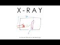 X-ray Imaging and CT Scan Concepts