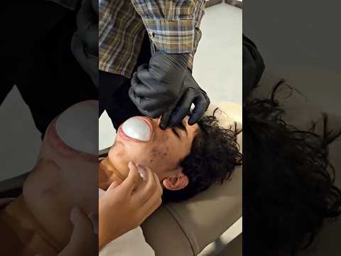 CFR- ট্রিটমেন্ট কেন করা হয়?