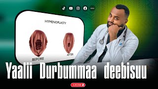 Durbummaan bade dhuguma Yaalaa jirtuu? Deebii