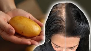 Hair Grows Like Crazy and Stops Falling Out! Most Powerful Natural Recipe!