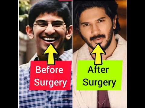 ഞെട്ടിപ്പോകും😱പ്ലാസ്റ്റിക് സർജറി ചെയ്ത് പണിപാളിയ മലയാള നടന്മാർ👄Plastic Surgery of malayalam actors👅👃