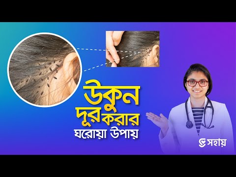 মাত্র ১ দিনেই উকুন দূর করার উপায় — ডা. তাসনিম জারা (চিকিৎসক, ইংল্যান্ড)