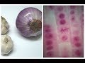 Microscopy Techniques and Cell Observation