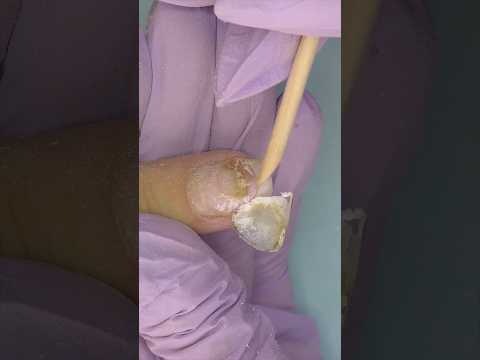 UÑA VERDE 🤢 Después de Extensiones de Uñas 😱