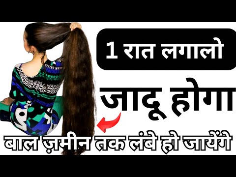 Coconut Oil रात मे सोने से पहले ऐसे लगालो, बाल दुबारा उगेंगे, बाल हो जायेंगे घुटनो तक लंबे,Long Hair