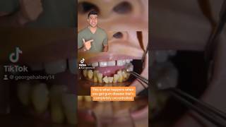 Typical British Teeth #funny #comedy #teeth #relatable #tiktok #tiktokvideo #georgehalsey
