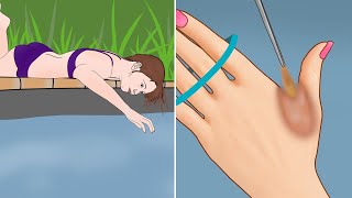 ASMR Remove Water Cockroach from infected hand animation