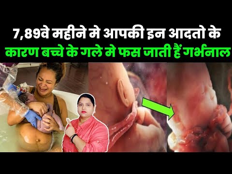 7,89वे महीने मे आपकी इन आदतो के कारण बच्चे के गले मे फस जाती हैं गर्भनाल|pregnancy